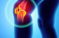 Arthrose du genou : quels traitements  en 2018 ?