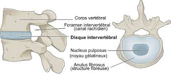 Actualité sur la lombosciatique et hernie discale lombaire | Atousante