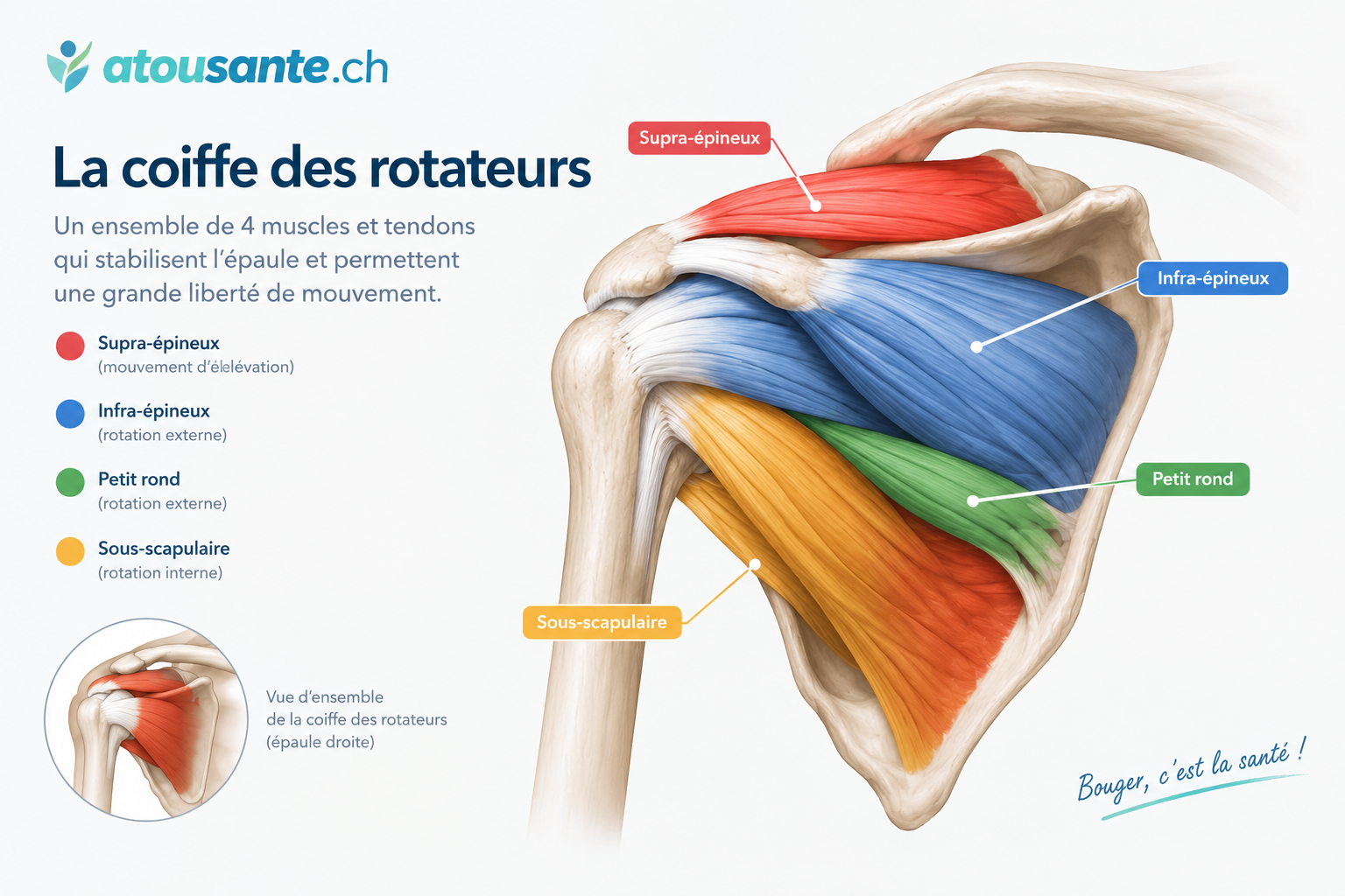 Lésions de la coiffe des rotateurs
